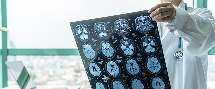 brain injury lawyers